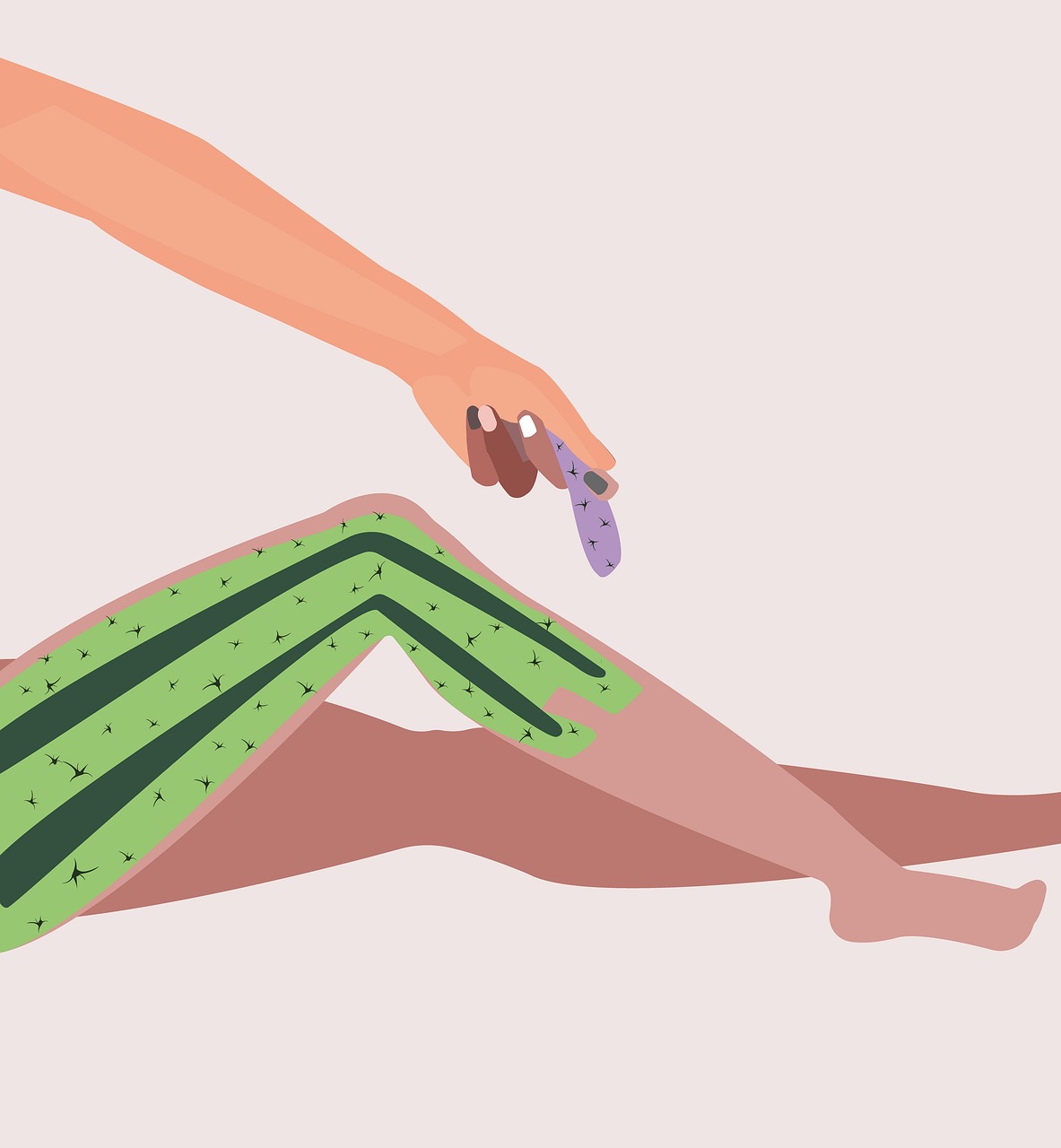 vio脱毛で黒ずみ改善は本当に可能？